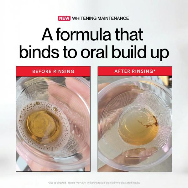 🔥Hot Sale 49% OFF🔥iD Stain Whitening Mouthwash