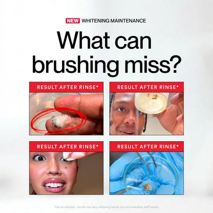 🔥Hot Sale 49% OFF🔥iD Stain Whitening Mouthwash